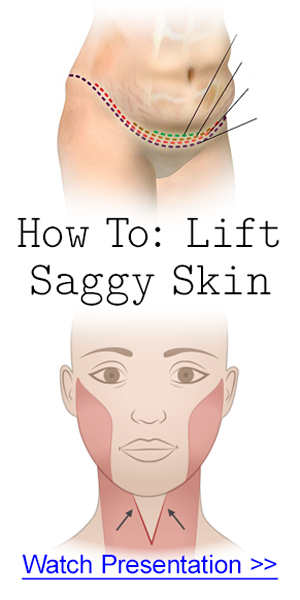 Lift Sagging + Firm Skin Without Surgery