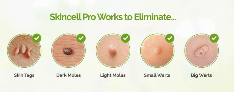 Skin Tag Removal Cream - SkinCell Pro, Advanced Mole and Skin Tag Remover