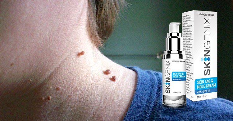 SkinGenix Ingredient - Get Rid of Skin Tags, Moles, and Warts Forever within 6 hours!  O ur “beauty marks” and imperfections make us who we are but, sometimes you don’t feel so confident. Those marks may be seen as “blemishes” to yourself not allowing you to see your true beauty underneath them.  It causes you to think people aren’t truly seeing you for who you are. You believe your blemishes are defining your identity and distracting people from the real you. It becomes difficult to understand your attractiveness and soon, your confidence is dwindling.  Skin tags and moles are common but, they are not pleasant. Not only do they look unattractive but, they get in the way of things as well.  Putting on clothing and scratching can all become a nuisance when you accidently irritate those specific areas.  You may even be doing your best to hide and ignore that they are there. However, that doesn’t make them go away.  The Good News is that the New Advanced Skin Tags and Mole Removal Product known as Skingenix works to remove skin tags from any part of your body in a safe and effective way.  What is SkinGenix?  Skingenix offers an all-natural, safe & time-tested solution to reduce and dry up skin tags, using it is a pain free alternative to expensive medical shots or invasive surgery!  Skingenix has been formulated to work across all skin-types and is equally effective for both men and women. Just a few applications and you will have bid goodbye to skin tags permanently.  Does Skingenix Really Work? Here Is HOW IT WORKS  Find out how Skingenix works at a cellular level to remove skin tags from the root and prevent their reoccurrence.  Skingenix has been formulated using ancient techniques discarded by mainstream medical science to remove Skin Tags in just hours. Proven over centuries, this humble remedy is now available to the American public!  CUTS OFF HYDRATION SUPPLY: Skingenix cuts off the supply of hydration to the skin tags, which prevents them from growing.  DRIES OFF SKIN TAGS: Regular use helps dry off the skin tags locally, and in a matter of hours they wither and fall off.  PREVENTS REOCCURRENCE: Supports skin hydration and nourishment to support its health and prevents the reoccurrence of skin tags.  Skintology MD Serum - Fast and Most affordable way to Remove Moles, Skin Tags and Warts in the Comfort of Your own Home.  Have you ever caught someone staring at your mole while you were talking to him or her?  Do you avoid buying certain clothing items to try and hide a mole or skin tag because you feel insecure?  Skin tags are small, flabby pieces of skin that hang off the body. While they are not dangerous, they can be unsightly and embarrassing.  Many people choose to have them removed for cosmetic reasons. If you are looking for a safe and effective way to Remove Skin Tags Yourself, keep reading! In this blog post, we will discuss the best ways to get rid of skin tags.  Do you have skin tags and want to know the best way to remove them Skin Tag Removal at Home? If so, you are not alone. Skin tags are a common problem, and there are many ways to remove them.  In this blog post on How to Remove Skin Tags quickly, safely, and effectively, we will discuss the best way to remove skin tags: safe and effective methods that will help you get rid of those pesky tags for good!  Skin tags are a common problem, and there are many ways to remove them. We will discuss the different methods that are available to you, as well as the pros and cons of each one.  We will also provide some tips on how to reduce your risk of skin tag recurrence. So read on to learn more about Skin Tag Removal at Home and the best way to remove skin tags!  1. What are skin tags and what causes them to form 2. The best way to remove skin tags - surgery, home remedies, or over-the-counter products 3. Pros and cons of each method of removal 4. How to care for your skin after tag removal surgery 5. What to do if skin tags grow back after removal 6. How to get rid of skin tags permanently What are skin tags and what causes them to form?  Skin tags are small, flabby pieces of skin that hang off the body. They are usually benign, meaning they are not cancerous or precancerous. Skin tags can form on any part of the body where there is skin-to-skin contact.  This includes areas like the neck, armpits, and groin. They can also form on the eyelids, under the breasts, and in folds of skin around the genitals. Skin tags are more common in people who are overweight or have diabetes.  The best way to remove skin tags - surgery, home remedies, or over-the-counter products?  There are a few different ways to remove skin tags. You can have them removed surgically by a dermatologist or cosmetic surgeon. You can also try home remedies, such as using tea tree oil or apple cider vinegar. Finally, there are over-the-counter products that contain chemicals that will dissolve the skin tag.  Can I remove skin tags at home safely?  Yes, you can remove skin tags at home safely using a number of methods. You can use a sharp object like a scalpel or scissors to cut them off, or you can use a cauterizing device to burn them off.  You can also freeze them off with liquid nitrogen. Whichever method you choose, make sure that you sterilize your instruments and clean the area thoroughly afterwards to avoid infection.  For most people, skin tags are a cosmetic concern and can be removed at home using over-the-counter products. However, some skin tags may be precancerous or could become infected, so it's important to consult your doctor before trying to remove them at home.  Pros and cons of each method of removal?  Order your Bottle of Best Skin Tags Removal Serum today.  Surgical removal is the most effective way to get rid of skin tags. However, it is also the most expensive, painful, and invasive option.  Home remedies are much less expensive and less risky, but they may not be as effective. Over-the-counter products are usually the cheapest option for Remove Skin Tags Yourself, but they may not work for everyone.  How to care for your skin after tag removal surgery?  If you have your skin tags removed surgically, you will need to take care of the incisions. Keep the area clean and dry. Apply an antibiotic ointment to the area if it gets infected. You should also avoid picking at the scabs or pulling on the stitches.  What to do if skin tags grow back after removal?  If your skin tags grow back after you remove them, you can try another method of removal. You can also talk to your doctor about other options, such as freezing or burning the skin tags off.  If you are concerned about your skin tags, without the need for a dermatologist or cosmetic surgeon treatment options, You should get this best skin tags and moles removal serum overnight Remove Skin Tags Yourself.  How to get rid of skin tags permanently  There are a few different ways that you can remove skin tags, but not all of them are created equal. Some methods may be more effective than others, and some may be more suitable for your situation.  Order your Bottle of Best Skin Tags Removal Serum today.  One popular method for removing skin tags is to tie a piece of thread or dental floss around the base of the tag. This will cut off the blood supply to the tag and cause it to eventually fall off.  Another method is to freeze the skin tag using liquid nitrogen. This will cause the tissue to die and the tag to fall off.  If you're looking for a safe and effective way to remove skin tags, we suggest trying Skin Tag Removal Cream or serum. DermaCorrect Skin tags removal serum is made with natural ingredients and is safe to use on all skin types.  It's also easy to apply and can be used on small or large skin tags. Best of all, it's gentle enough to use on sensitive areas like the face, neck, and armpits.  To use Amarose Skin Tags Removal Serum, simply apply a small amount to the skin tag and massage it in until it's fully absorbed. Repeat this process once or twice a day until the skin tag falls off. For best results, we recommend using Amarose Skin Tags Removal Serum for at least two weeks.  If you have any questions about how to remove skin tags, please feel free to contact us. We're always happy to help!  We hope this How to Remove Skin Tags blog post was helpful! If you have any questions, please feel free to leave a comment below.  Best way to remove skin tags under breasts  There are a few ways that you can remove skin tags under your breasts at home. One way is to tie a piece of string around the base of the skin tag.  This will cut off the circulation to the skin tag and cause it to fall off. Another way is to apply a topical solution or cream to the skin tag.  This will cause the skin tag to shrink and eventually fall off. If you are not comfortable doing either of these things, you can always see a doctor or dermatologist to have the skin tag removed.  If skin tags are small and not causing any discomfort, you may be able to remove them at home using topical treatments. There are a number of over-the-counter creams and ointments that can be effective in treating skin tags.  If skin tags are larger or more bothersome, you may need to see a doctor to have them removed. A doctor can use a number of different techniques to remove skin tags, including freezing them off with liquid nitrogen or cutting them away with a scalpel.  Is There a Way to Prevent Skin Tags?  There is no guaranteed way to prevent skin tags, as they can occur for a variety of reasons. However, you may be able to reduce your risk by maintaining good hygiene and avoiding friction or irritation to the skin.  For example, if you are prone to skin tags in areas where your skin rubs against clothing, you may want to wear loose-fitting garments.  If you have diabetes or another condition that causes poor circulation, keeping your skin clean and moisturized can help to prevent skin tags.  Most skin tags are benign and do not require treatment. However, if you have diabetes or another condition that causes changes in your skin, you may be more likely to develop skin tags.  Order your Bottle of Best Skin Tags Removal Serum today.  Skin tags and moles Surgically Removal is Highly Expensive!  Skin tags Surgically Removal The procedure involves cutting or burning the mole or skin tag off the body. Depending on the size and location of the mole or skin on your body, It’s been described as a very painful procedure!  how to remove skin tags in one night  And as with most surgical procedures, you may up with a scar often worse the mole or skin tag you had removed. See for yourself below… Did you know the average cost for removal surgery is $500?!  Most surgical procedures, you may up with a scar often worse the mole or skin tag you had removed. See for yourself below…  No one wants to continue living in depression and unacceptance due to their moles, skin tags and other blemishes.  We shouldn’t let them consume us and who we truly are.  But, what if there was a simple, more affordable, homeopathic formula for you? No more thoughts of the expenses and pain. No worries of scars left behind after surgery or the effects of other procedures.  Save yourself money and pay less than a normal skin tag removal surgery!  Naturally reduce the appearance of Skin-Tags, Plantar Wart and unwanted Moles in just a few drops a day.  Millions of people are amazed that one product "SkinCell Advanced™" formula has been scientifically proven to:  You don’t need to worry about painful and expensive medical procedure to remove those unsightly skin tags. Simply use Skintology MD and your skin tags could all be gone in just a few hours.  This cream has been designed to cater to all skin types. Be it oily or normal, dry or sensitive, it works on all skin types. This works really fast and better than other expensive methods like surgery.  - Remove Moles & Skin Tags Anywhere On Your Body - Permanent Results In As Little As 8 Hours - Removes Warts In The Privacy Of Your Own Home - Leaves No Scares Or Marks - Also has natural ingredients which help as a  skincare cream - Removes Acne Scaring & Other Unsightly Marks - FDA Approved  Benefits Of Using Skintology MD  These cream and Serum as been proven to have multiple benefits, they are made with the best of ingredients which can solve skin lesion problems at the lowest rates.     Click Here To order SkinCell Pro Serum Advanced Skin Tags Removal >>  .  Skintology MD has made the white mole and skin tag remover just to help with the unwanted excess skin growths and it does exactly what it says. The benefits of this cream include:  Helps in diminishing moles: It clears out the skin cell clusters, which get developed to find moles and slowly helps reduce them and make them non- existent. Reduces the skin tags: Skin tags can be easily wiped out from your body with the help of this cream with proper use of it. Nourishes the skin: Your skin loses out on a lot of nourishment when there are lesions on the skin, this cream helps in providing your skin with the nourishment it needs. Clears clogged pores: Due to the external growths, your skin may get clogged at times which can be cleared out with the help of the Skintology MD cream.  SkinCell Advanced™ is the fast and easy solution for unwanted moles and pesky skin tags in the comfort of your own home! SkinCell Advanced™ mole and skin tag corrector powerful serum is made from natural  Have you ever caught someone staring at your mole while you were talking to him or her?... Do you avoid buying certain clothing items to try and hide a mole or skin tag because you feel insecure?  Get your confidence back and take back your life. This painless and affordable at home removal method will save you time and money.  Is natural skin tag removal effective?  Yes, natural skin tag removal is effective. There are a number of home remedies that can be used to remove skin tags. These include using a sharp knife or scissors to cut the skin tag off, using duct tape to suffocate the skin tag, or applying a mixture of baking soda and vinegar to the skin tag.  There is no definitive answer to this question since there is no scientific evidence to support or refute the claims made by manufacturers of natural skin tag removal products. However, many people report success in using these products to remove skin tags.  Safe and effective way to remove skin tags, we suggest trying Skin Tag Removal Cream or serum. DermaCorrect Skin tags removal serum is made with natural ingredients and is safe to use on all skin types.  It's also easy to apply and can be used on small or large skin tags. Best of all, it's gentle enough to use on sensitive areas like the face, neck, and armpits.  To use Amarose Skin Tags Removal Serum, simply apply a small amount to the skin tag and massage it in until it's fully absorbed. Repeat this process once or twice a day until the skin tag falls off. For best results, we recommend using Amarose Skin Tags Removal Serum for at least two weeks.  How Does Skintology MD Work?  A few drops of the by Skintology MD’s mole and tag remover if used regularly can help by diminishing the skin clusters and minimizing them and the tags as well and slowly reducing them to the point of nonexistence.  It also helps by providing your skin with hydration and nutrition from preventing them from drying out.  Skintology MD Cream Review: Why Consider This? The skin tag removal surgery treatments is expensive, painful, and risky. This do not guarantee definite results and to top it all, its might result in the skin bleeding, severe skin infection and even skin scarring!  Order your Bottle of Best Skin Tags Removal Serum today.  Skintology MD Skin Cream is an easy, accessible, cost-effective, and painless method to successfully uproot moles and tags (1).  The users need to apply this cream to the target area for 30 minutes, every day. The makers assure about the visible results within a few weeks into the application program.  Skin Tag Removal: Three Step Home Remedies That Work  Can You Scrape Skin Tags Off?  You can scrape off skin tags with a sharp object. However, this is not recommended as it can lead to infection or bleeding.  Yes, you can scrape skin tags off yourself with a sharp object like a razor blade or a scalpel. However, be very careful not to cut yourself. It's also important to sterilize the object you're using to avoid infection. If you're not comfortable doing this yourself, you can ask your doctor or dermatologist to do it for you.  If you're looking for a safe and effective way to remove skin tags, we suggest trying Skin Tag Removal Cream or serum. DermaCorrect Skin tags removal serum, Amarose Skin Tags Removal Serum is made with natural ingredients and is safe to use on all skin types - just apply the serum daily until the skin tag.  How To Use Skintology MD Serum  How to get rid of skin tags with Skintology MD Cream  You just wash and dry the affected parts and apply the liquid  Skintology skin tag removal cream with a cotton bud twice or thrice daily Wash your face using a suitable cleanser Dry using a clean towel Apply Skintology Skincare on your face and the area around and beneath your eyes Leave it to absorb Use regularly for optimal results How Much Does Skintology MD Cream Cost?  The brand’s website shows three tiers of prices for it’s skintology products, the Skintology MD intensive healing cream comes with quantity discount:  Skintology MD serum will help you Get Ride of Skin Tags, Moles, and Warts At Their Very Root, From The Comfort Of Your Own Home ... Say goodbye to expensive medical shots or invasive surgery! Order your Bottle today.  1 Bottle Skintology MD Serum:      $59.99 Skintology MD Money Back Guarantee Policy  Skintology cream is backed with a 30-day money back guarantee. Click here to visit their Official Website to order Skintology MD Mole & Skin Tags Removal Cream or Serum  Skintology Cream or Serum is all-Natural Skin Cream For Defeating Skin Tags, Moles, and Warts At Their Very Root, From The Comfort Of Your Own Home. Try It Today  Order your Bottle of Best Skin Tags Removal Serum today.  Click Here To order SkinCell Pro Serum, Advanced Skin Tags Removal >>   . . Ingredients of SkinGenix  Skingenix Ingredients included this cream are checked and affirmed by the skin specialists. Also, they guarantee that every one of the segments utilized in this are acquired from the characteristic source so there would be no compelling reason to stress over it.  Skingenix Ingredients Turmeric extracts –Turmeric has mitigating benefits which lessen the flaws and pigmentation and quiet the skin conditions like rosacea and dermatitis. Despite the fact that, it is best for the issue of skin break out  Skingenix Ingredients Aloe-Vera- Essentially Aloe-Vera contains the calming and cooling properties which mend from the unsafe beams of the sun and lessens skin disturbance, irritations  Skingenix Ingredients Vitamin C–Vitamin C gives a more brilliant and clear skin by battling against the issue of pigmentation and furthermore shields from the untimely maturing  Skingenix Ingredients Vitamin E– It controls the perceivability of dark circles and furthermore expels the perceivability of dead skin cells. Vitamin E– keeps delicate skin cells.  Advantages of SkinGenix  Millions of people are amazed that one product "Skingenix Skin Tag Removal" was able to do all of the following:  Remove Moles & Skin Tags, Plantar Wart Anywhere On Your Body Permanent Results In As Little As 8 Hours Removes Warts In The Privacy Of Your Own Home Leaves No Scares Or Marks Removes Acne Scaring & Other Unsightly Marks  How To Use SkinGenix Skin Tags Removal  GET RID OF SKIN TAGS IN 3 SIMPLE STEPS:  Step 1: CLEAN Clean the area around the skin tag thoroughly before applying Skingenix  Step 2: APPLY Saturate the Skin Tag with Skingenix using a cosmetic pad or applicator  Step 3: ENJOY Wait 6-8 hours for the Skin Tag to fall off. If needed, reapply Skingenix or Visit Official Website to Order the Cream.  Where to Buy SkinGenix?  Skingenix is trusted by people across the United States of America, as a safe and effective formula for skin tag removal.  Skingenix is ALL NATURAL SOLUTION FOR SKIN TAG REMOVAL! Skingenix offers an all-natural, safe & time-tested solution to reduce and dry up skin tags, using it is a pain free alternative to expensive medical shots or invasive surgery!  Click Here to Visit Official Website  . . .