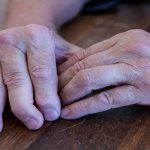 Psoriatic-Arthritis-Symptoms-and-Signs