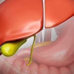 symptoms-of-gall-bladder-issues